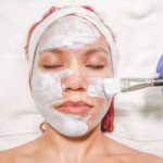 chemical peel treatment
