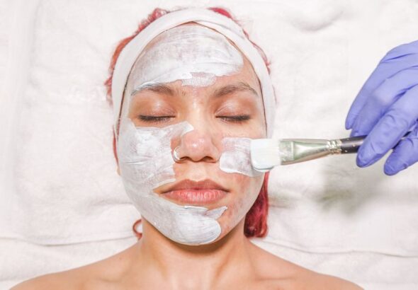 chemical peel treatment