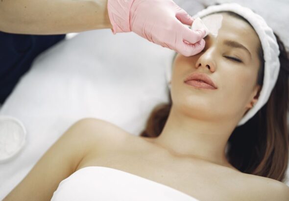 chemical peel treatment
